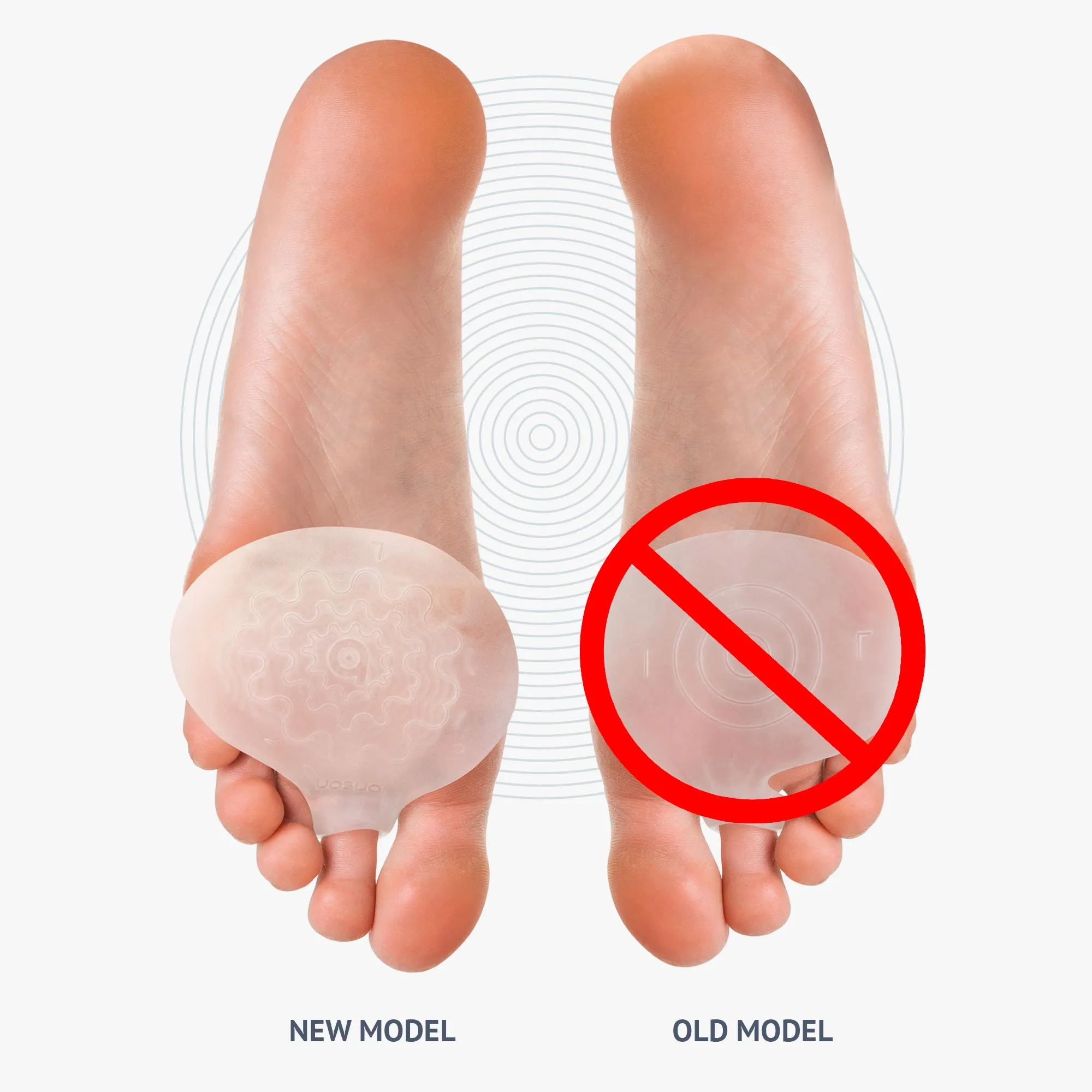 Metatarsal Pads  [2pcs]